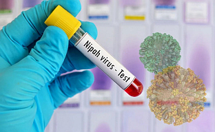 Република Српска - Институт за јавно здравство