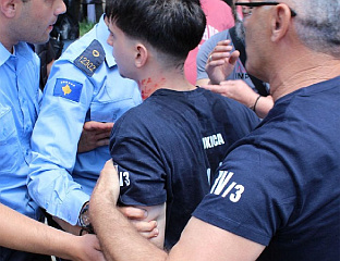МЕЂУНАРОДНА ЗАЈЕДНИЦА ДА РЕАГУЈЕ НА ПРОВОКАЦИЈЕ И ПРЕКОМЈЕРНУ СИЛУ КОСОВСКЕ ПОЛИЦИЈЕ