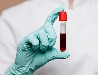 ОЛОВО У КРВИ УТВРЂЕНО КОД 53 ЛИЦА