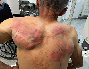 ПРИПАДНИЦИ ТАКОЗВАНЕ КОСОВСКЕ ПОЛИЦИЈЕ ПРЕТУКЛИ СРБИНА У ЗУБИНОМ ПОТОКУ