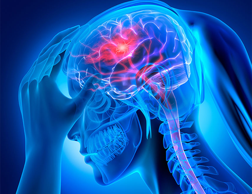 ИСТОЧНО САРАЈЕВО, 29. ОКТОБРА /СРНА/ - Мождани удар данас је водећи узрок инвалидитета у свијету и други водећи узрок смрти, зато је важно препознати симптоме и одмах затражити помоћ, саопштено је из Болнице "Србија" поводом Свјетског дана борбе против можданог удара, који се обиљежава 29. октобра.