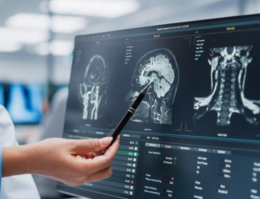 БИЈЕЉИНА, 2. ФЕБРУАРА /СРНА/ - Истраживачи су, користећи напредно снимање магнетном резонанцом и податке о готово 26.000 људи, идентификовали два изненађујућа обрасца масноће повезана са бржим старењем мозга, когнитивним пропадањем и већим ризиком од неуролошких болести.