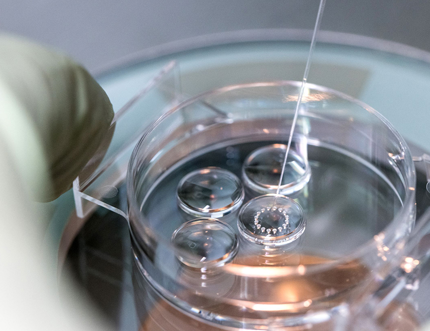 ПРИЈЕДОР, 6. ФЕБРУАРА /СРНА/ - Град Приједор донио је нови правилник о расподјели средстава за подршку пронаталитетној политици којим је износ једнократне помоћи женама за вантјелесну оплодњу увећан са 5.500 на 6.500 КМ, а доб жена са 42 на 48 година.