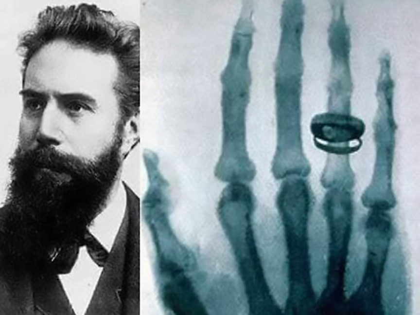 БИЈЕЉИНА, 26. МАРТА /СРНА/ - Њемачки физичар Вилхелм Конрад Рендген, проналазач икс зрака и добитник Нобелове награде за физику, рођен је 27. марта 1845. године.