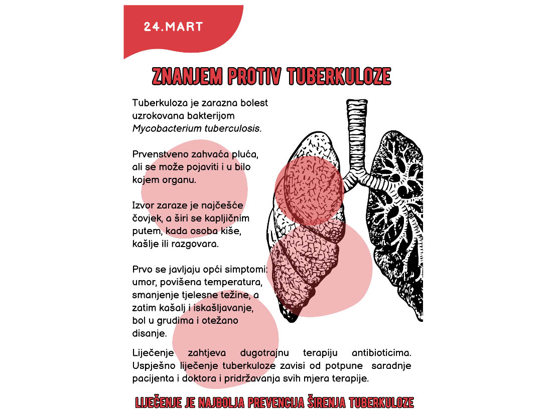БАЊАЛУКА, 24. МАРТА /СРНА/ - Институту за јавно здравство Републике Српске прошле године је пријављено 113 новообољелих од туберкулозе, од којих је шест преминуло, речено је Срни у Институту, поводом Свјетског дана борбе против туберкулозе.
