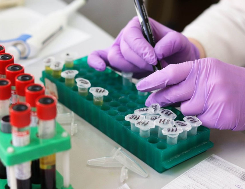 ВАРЕШ, 24. АПРИЛА /СРНА/ - Олово у крви потврђено је код свих 85 тестираних грађана Вареша, а нек иод њих су већ за болничку терапију.