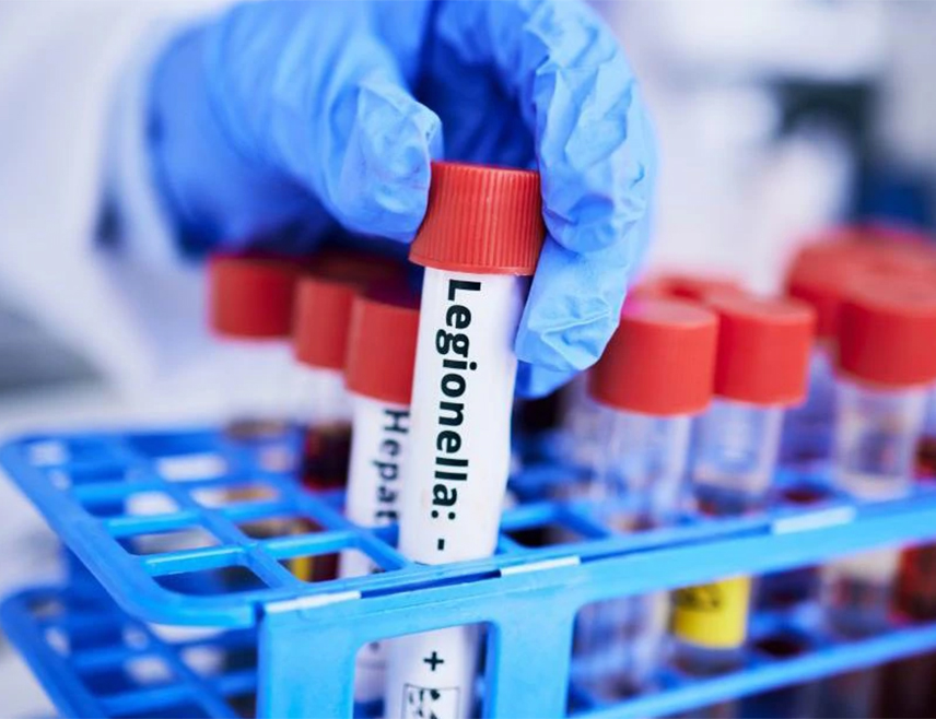 ZAGREB, MAY 30 /SRNA/ - The presence of Legionella bacteria has been confirmed at the Faculty of Economics in Zagreb.